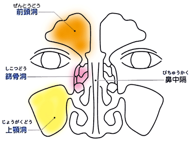 副鼻腔炎