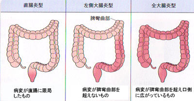 鍼灸治療