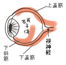 黄斑変性症